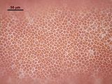 3 – Cellule corticali in visione superficiale
